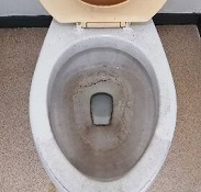 便器クリーニング前